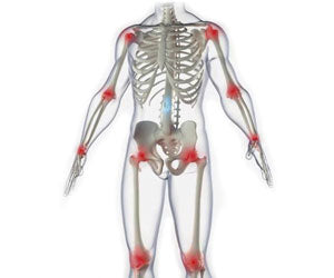 RXB Complex 2x1 49,99€