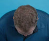 Hair Grow Max 2x1 a 49,99€
