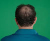 Hair Grow Max 2x1 a 20.021,60 HUF